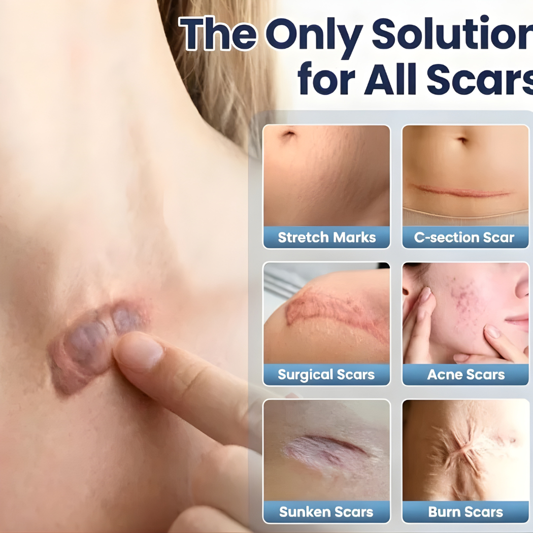 Scar Repair Cream